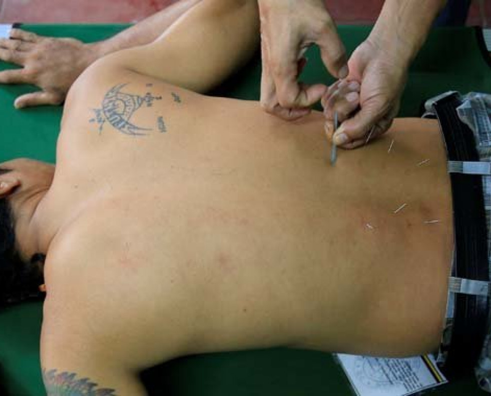 La mitad de los españoles confía en la acupuntura y la homeopatía