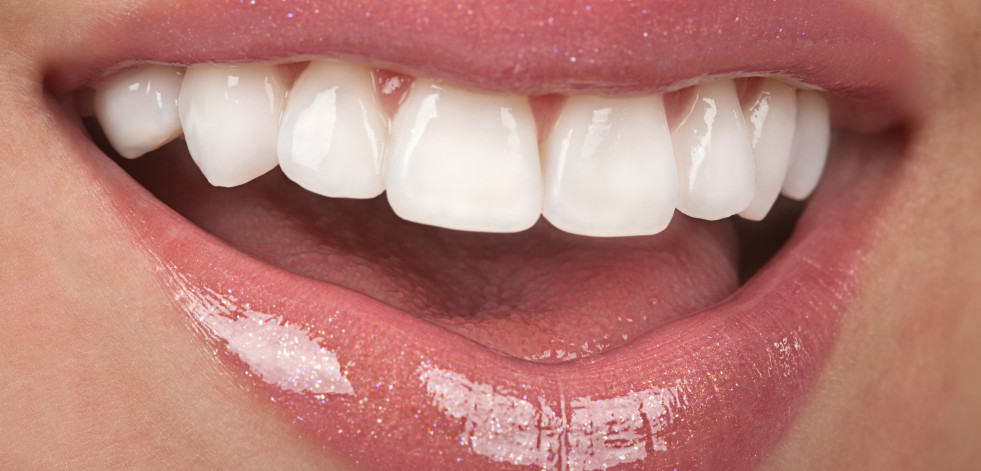 Ya puedes recuperar tu sonrisa gracias a las carillas dentales