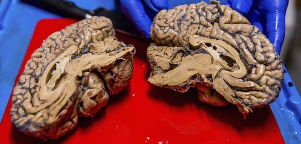 Controlar un producto del cerebro mejora el oído musical