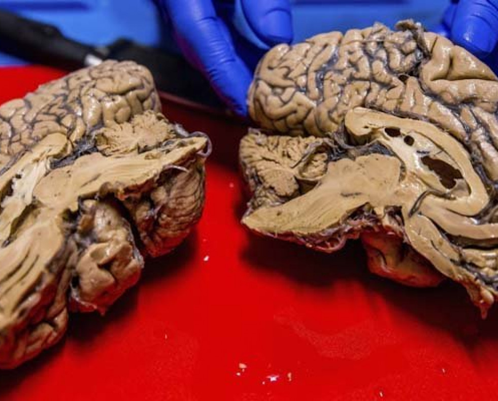 Controlar un producto del cerebro mejora el oído musical