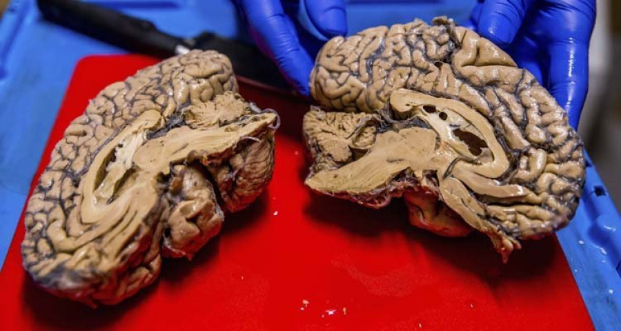 Controlar un producto del cerebro mejora el oído musical