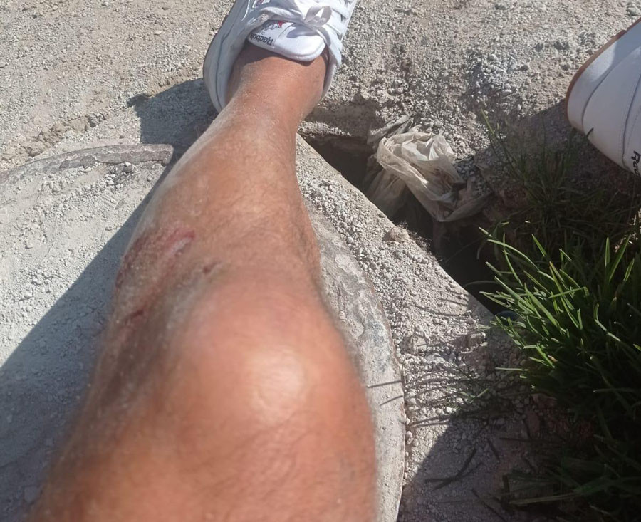 Herido un armador en una pierna al caer en una zanja sin vallar en Ribeira