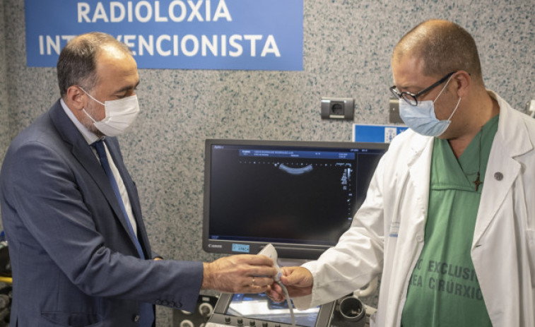 La Xunta renueva más de 60 ecógrafos en los hospitales gallegos con una inversión de 5,3 millones
