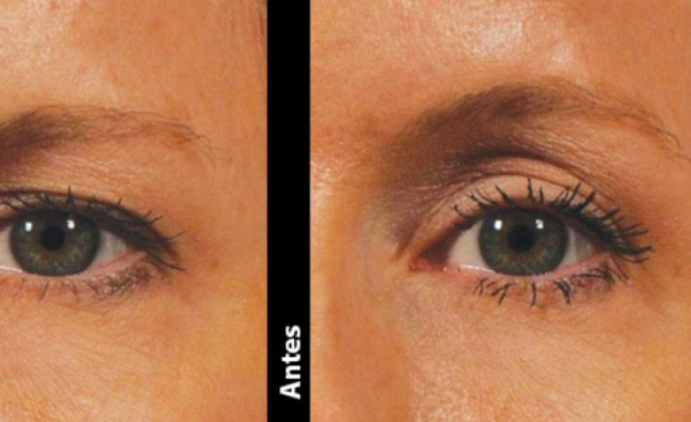 Luce una mirada atractiva gracias al centro médico estético Kerala