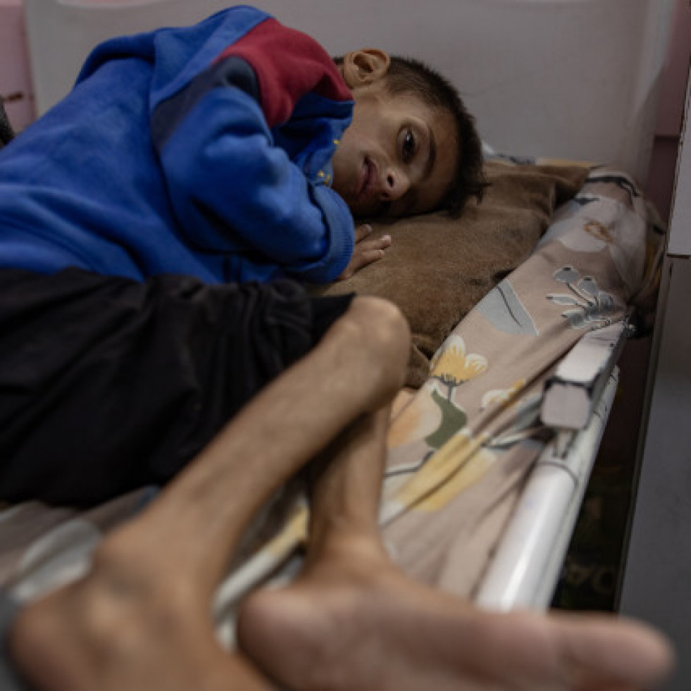 La ONU declara oficialmente la hambruna en la ciudad de Gaza y alrededores